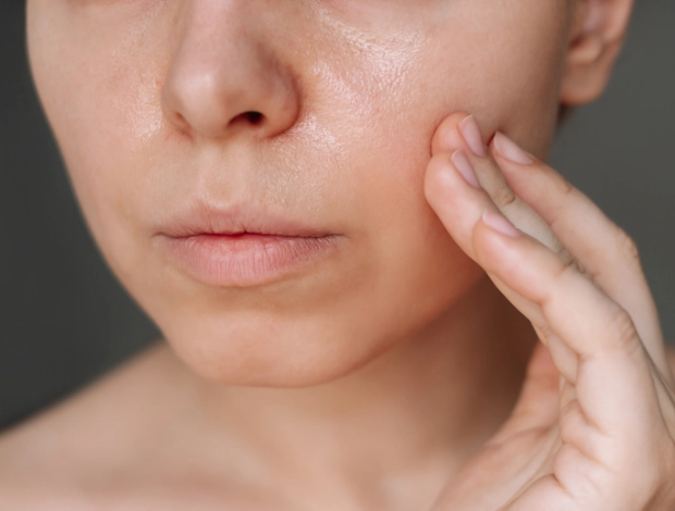 PDRN + Microneedling